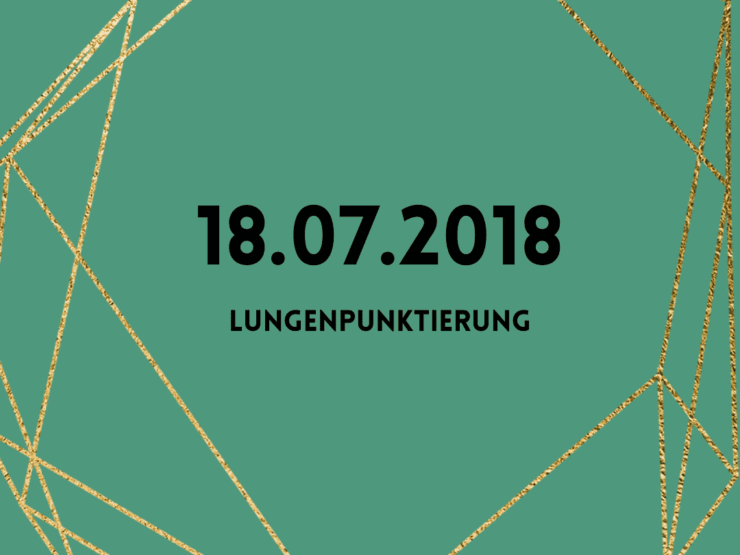 18.07.2018 – 28 Grad Celsius